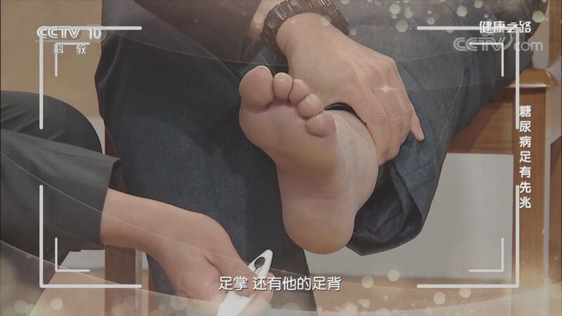 健康之路 《健康之路》 20201019 糖尿病足有先兆