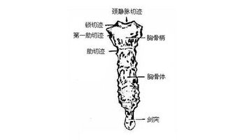 颈静脉切迹