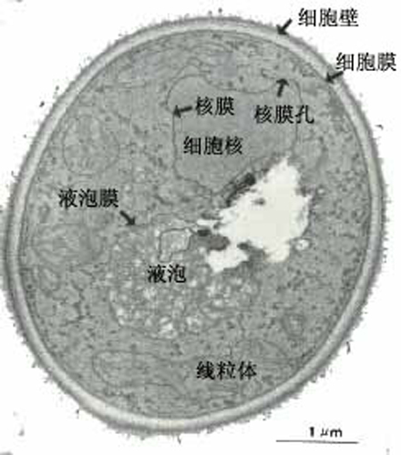 酵母菌的子囊孢子图片